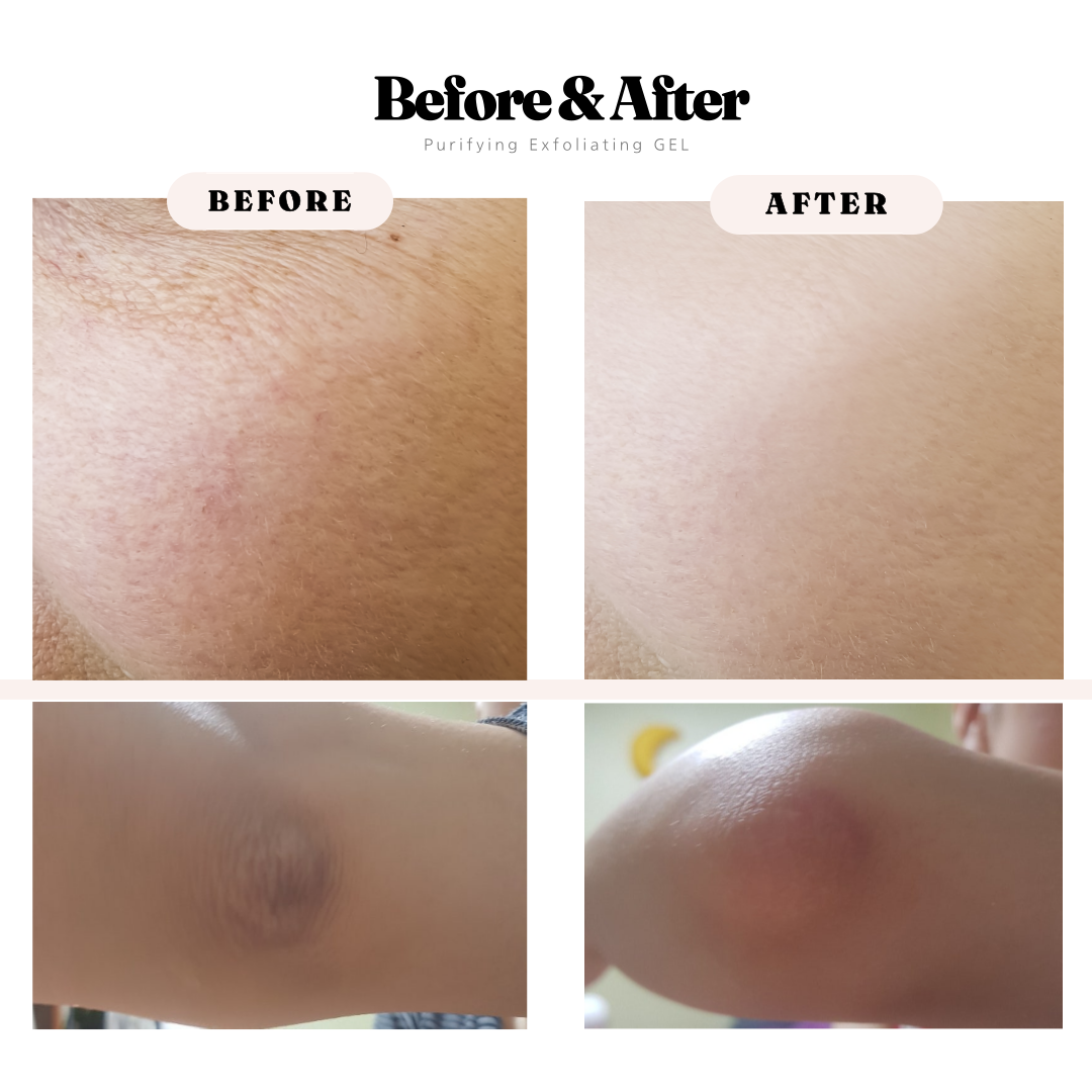 Purifying Exfoliating Gel - Moisturizing and Repairing